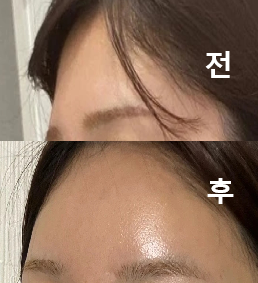 결과가 예뻐서 정말 기뻤어요!