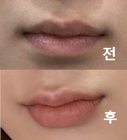 시술 시간도 빠르고 꼼꼼하세요!