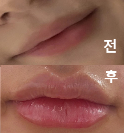 너무 예쁘게 잘 되어서 재방문 했어요!