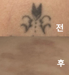 후케어를 위한 용품도 잘 챙겨주세요!