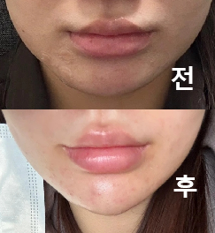 모양 예쁘게 해주시고 맞춤형 상담으로 진행되었어요!