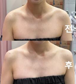 체구가 작아서 큰 옷 입고 다니는 분들께 추천드려요!