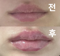 지금까지 해본 것 중에 가장 이상적인 입술 모양으로 만들어주셨어요!
