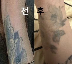 원하는 마취 시간 맞춰주셨어요!