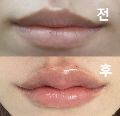 상담이 꼼꼼하고 원하는 점을 잘 들어주셨어요!