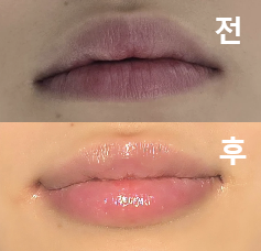 원장님이 디자인 너무 잘해주셔서 만족스러워요!