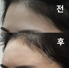 안심하고 시술 받을 수 있었어요!