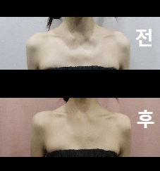 I am satisfied because the procedure went very smoothly!