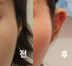 정면에서는 귀가 잘 안보였는데 이제 잘 보여서 신기해요!
