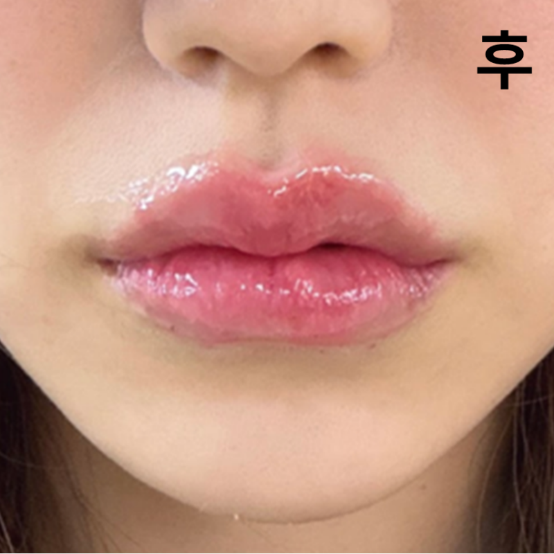 저번에 방믄했을때 너무 좋았어서 재방문했습니다. 이번에도 아주 예쁘게 마무리해주셔서 대만족입니다!