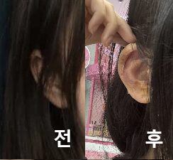 중안부가 짧아 보이고 다들 예쁘다고 칭찬해주셨어요!