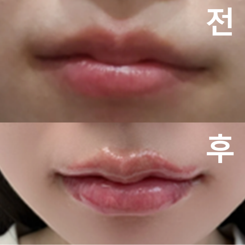 강요 없이 예쁜 실장님이 상담해주셨어요. 지하철역에서도 가까워서 다음에 한국에 오면 또 방문하고싶어요!