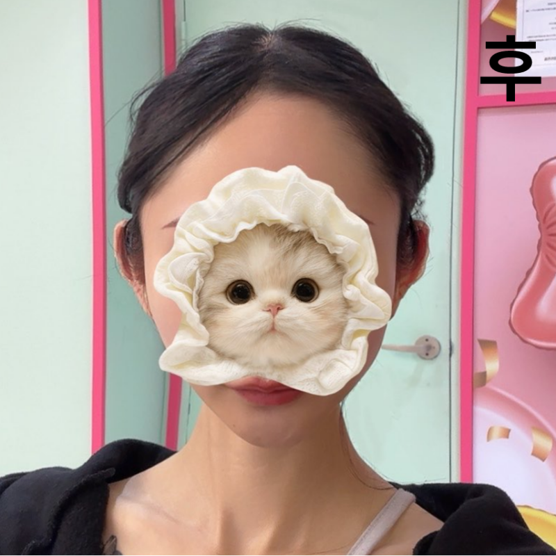 귀필러 하고 왔어요! 하나도 안 아팠고 원하던 모양이 나와서 귀엽고 완전 만족이에요!