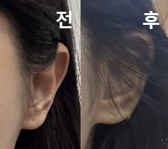 정말 귀필러 고민 많이 했는데 제 고민 다 해결해 주셨어요!