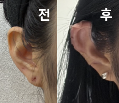 제 얼굴 비율에 맞게 해주셔서 만족해요!