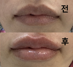 항상 제가 원하는 이상적인 입술을 만들어 주셔서 대만족입니다!