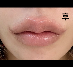 매번 결과에 대만족 해서 계속 재방문 중이에요!