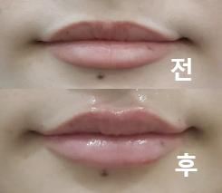 입술 모양이 정말 마음에 들었어요!