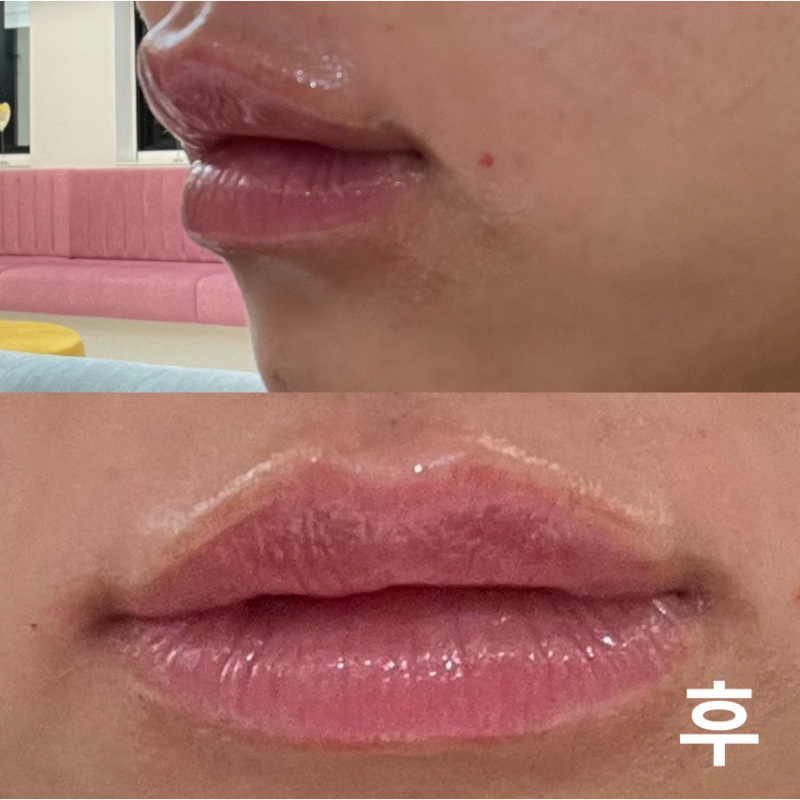 모두 꼼꼼하게 해주시고 통증도 없어서 대만족입니다!