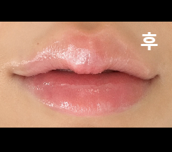 상담도 꼼꼼하고 직원분들도 다 친절하셨어요!