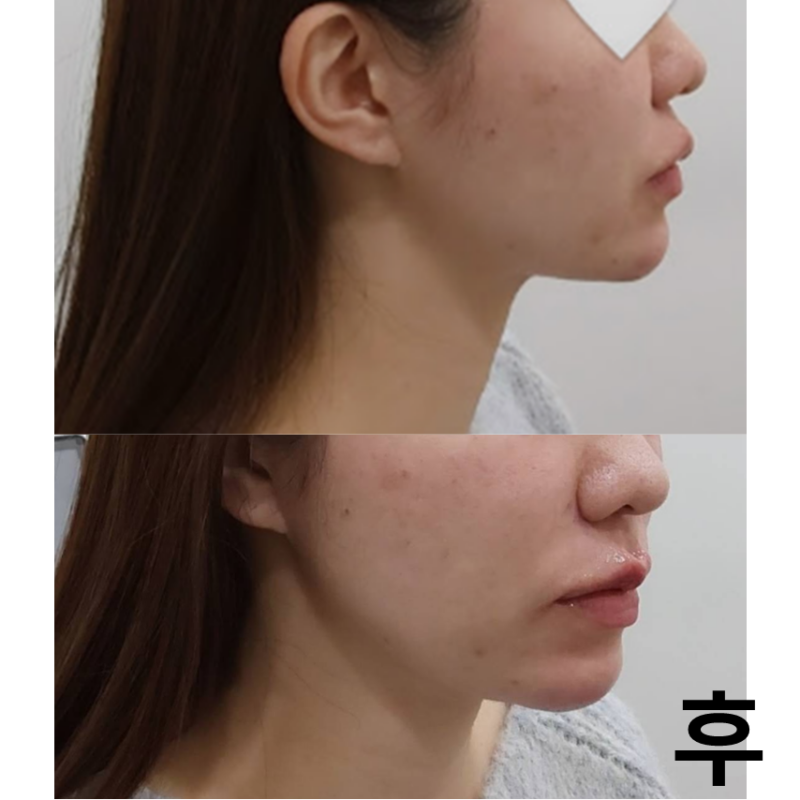 세 번째 방문입니다! 원장님도 실장님도 친절하셔서 대만족입니다!