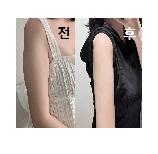 하나도 안 아프고 바로 일상생활 가능했어요!