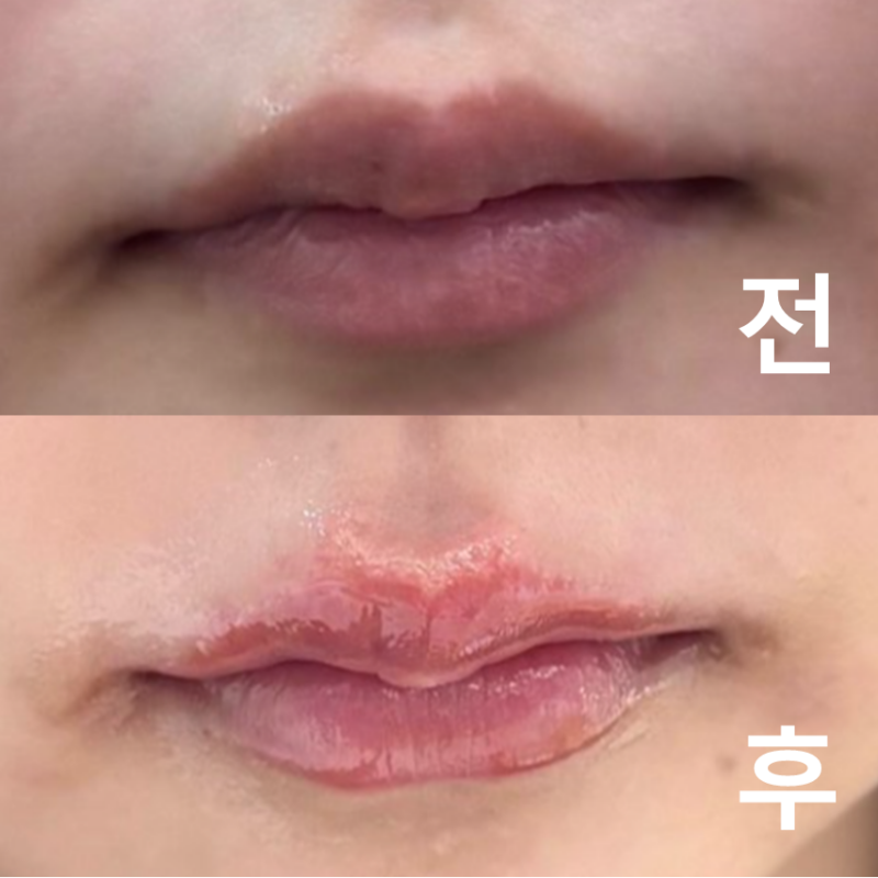 예산에 맞춰서 진행해주셨고 대기 시간도 거의 없어서 편하게 받고 왔어요~