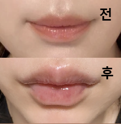 직원분들이 친절하셔서 안심했어요!