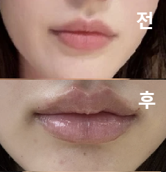 상담이 빠르고 쭉쭉 진행되어 좋았어요!