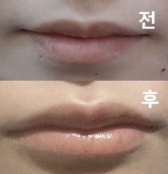 처음 시술이라 긴장했는데 친절하게 대해주셔서 긴장이 풀렸어요!