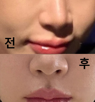 직원분도 원장님도 친절해서 즇아요