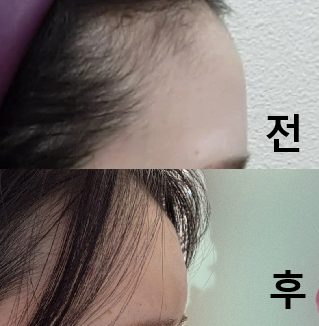 상담을 해주신 언니가 너무 상냥하고 정성스럽게 상담해줘서 시종일관 안심할 수 있었어요!!