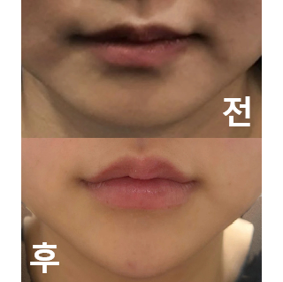 시술중에도 상냥하게 말을 걸어주고, 완성형도 마음에 듭니다!