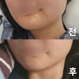 줄어드는게 보이니까 만족감이 큽니다