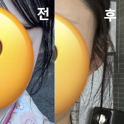 효과가 바로 보여서 정말 기뻐요!