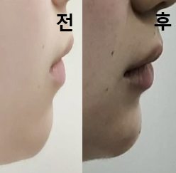 2번째 방문인데 여전히 꼼꼼하게 해주세요!
