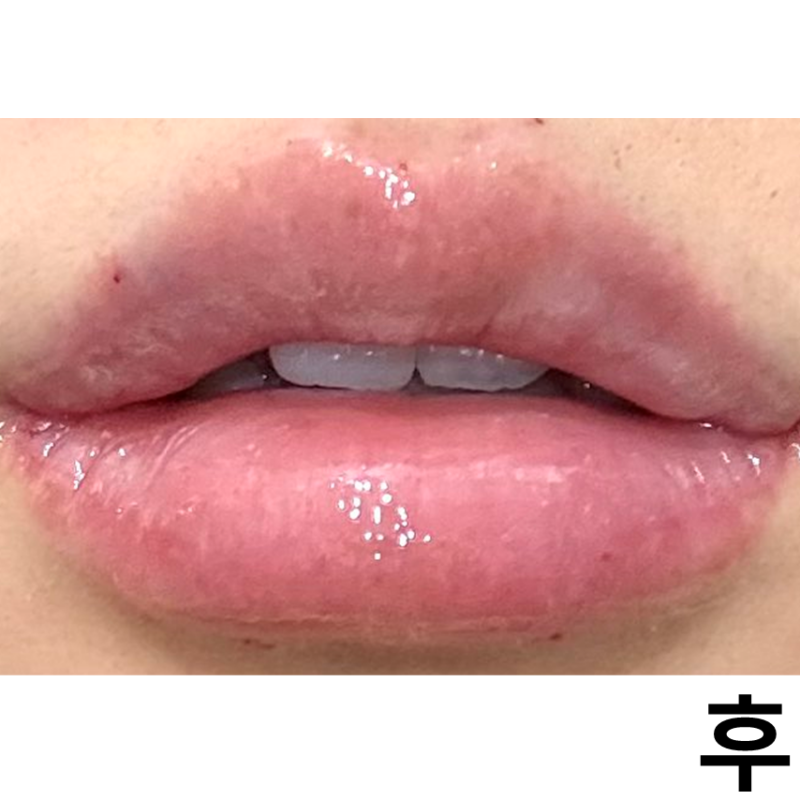 모양도 너무 마음에 들어서 대만족이에요!
