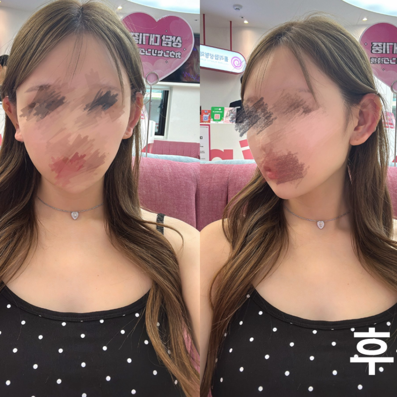 귀필러 얼굴 작아 보여서 너무 좋아요!