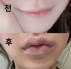 입술 볼륨이 있었으면 해서 자연스럽게 부탁드렸어요!