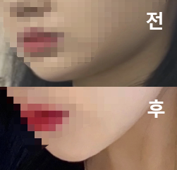 고민 부위를 친절하게 상담해주셨어요!