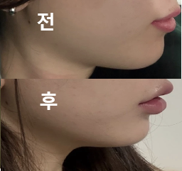 대기도 별로 없고 다들 친절하세요!
