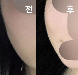 만나는 사람마다 살 빠졌냐고 물어봐요!