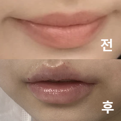 원장님이 진짜 엄청 꼼꼼하게 봐주세요!