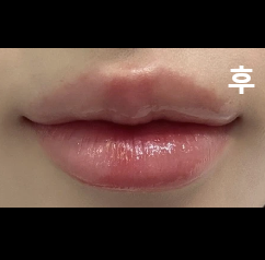 직원분들 다 친절하시고 원장님 최고!