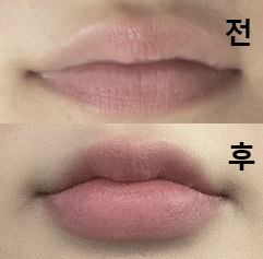 요구사항 다 들어주시고 조절해 가면서 시술해 주셔서 좋았어요!