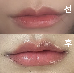 제가 원하는 입술 모양이 되어서 너무 만족스러워요!