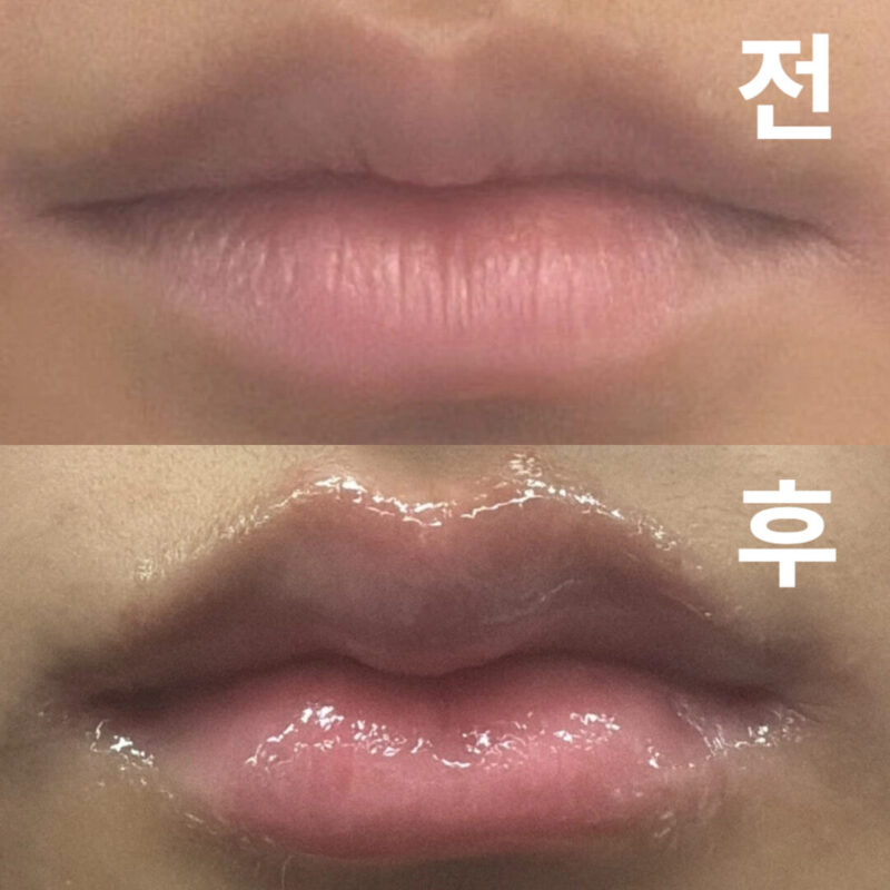 직원분들도 정말 친절하시고 상담 실장님께서 상담을 친절하게 잘헤주셔서 좋았어요