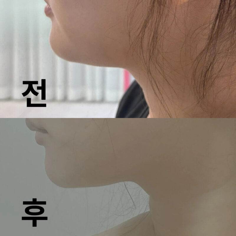 꼼꼼하게 물어봐주시고 통증 없이 잘 맞았습니다.