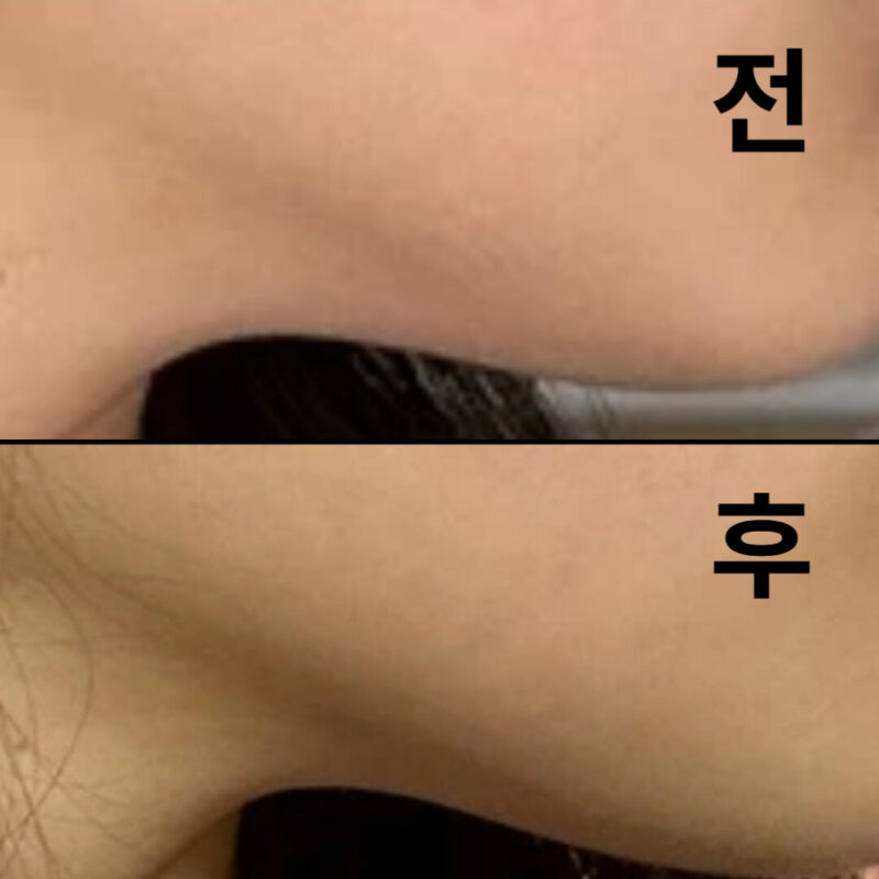 2회차부터 티나는 효과가 있는 것 같아요