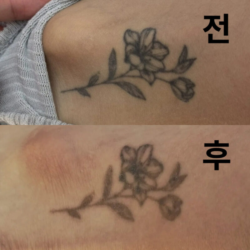 오늘 두번째인데 많이 지워졌어요